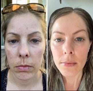 Reduce redness & irritation