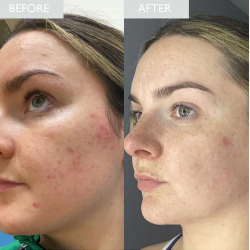 Reduces fine lines & wrinkles